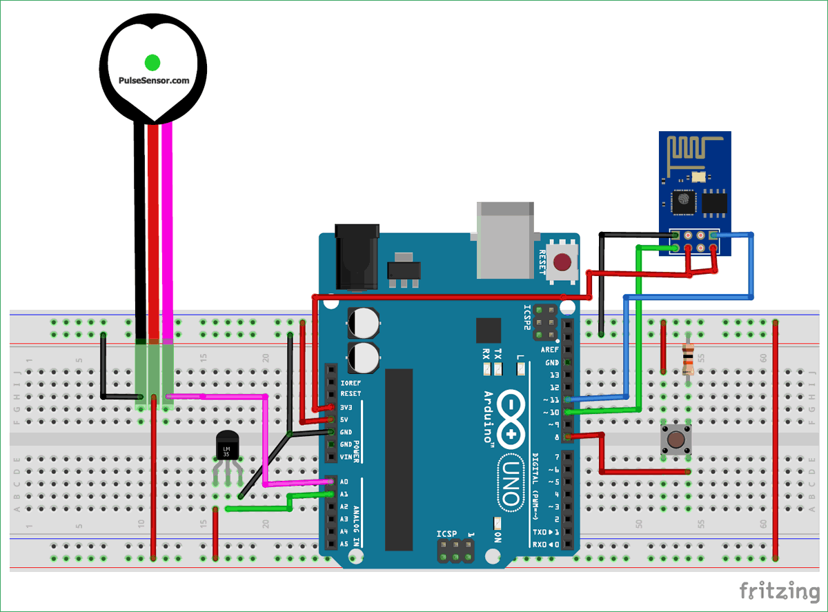 Circuit Diagram for IoT based Patient Monitoring System using ESP8266 and Arduino