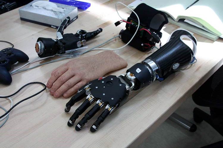 How New Technology Advancements Have Enhanced The Modern Prosthetic Devices