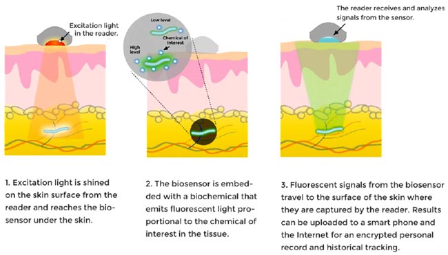 Implantable sensor working