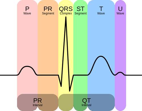 AD8232 ECG Sensor Graph