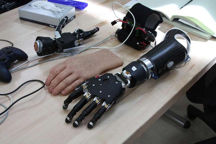 How Bionics are Redefining the Future of Prosthetics