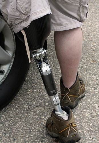 Bionic Legs
