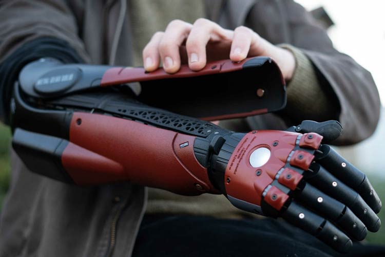 Hero Arm by Open Bionics