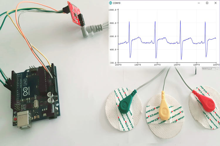 AD8232 ECG sensor with Arduino 