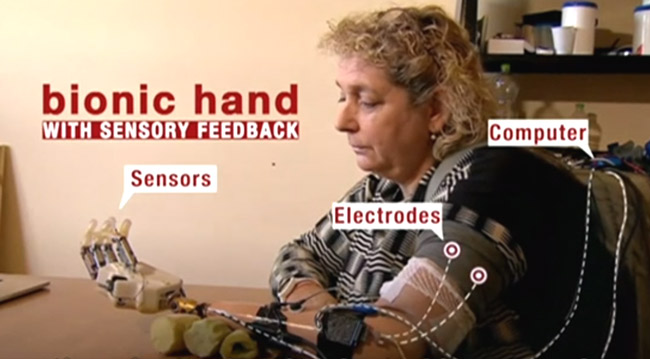 Bionic Hand with Sense of Touch