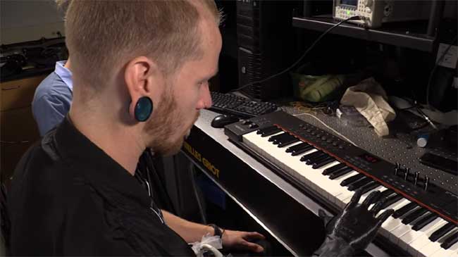Bionic Hand Enables Amputees Control Individual Prosthetic Fingers and Play Piano