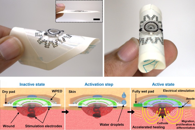 Water-Powered Electric Band-Aid Speeds Up Wound Healing