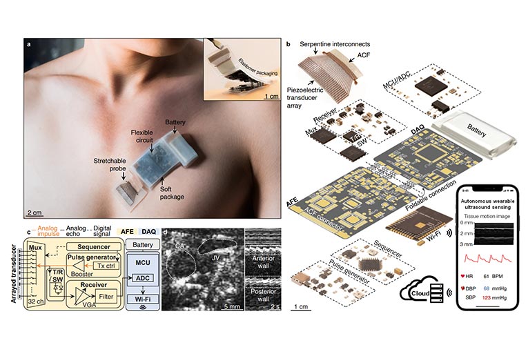 Wearable Ultrasound System