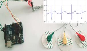AD8232 ECG sensor with Arduino 