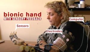 Bionic Hand with Sense of Touch
