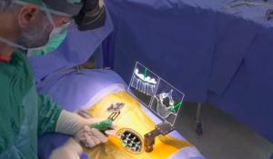 Xvision Spine – FDA Approved Augmented Reality Surgical Guidance System